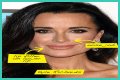 Botox, Implants & More! – Hollywood Life